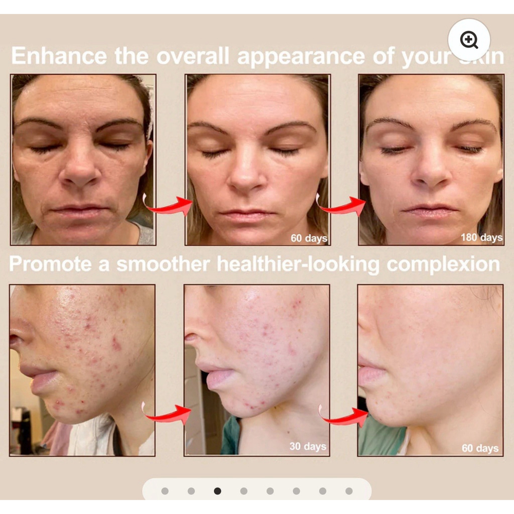 Face Mask Light Therapy Pro Skinhaven - Picture 4 of 9